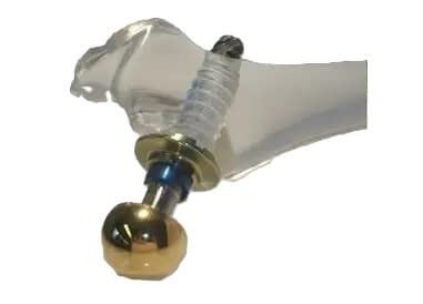 HELICA TPS Stem